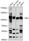 Transducin Beta Like 3 antibody, 13-395, ProSci, Western Blot image 