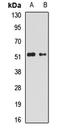 Gamma-Aminobutyric Acid Type A Receptor Alpha5 Subunit antibody, orb412926, Biorbyt, Western Blot image 