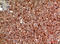 Angiogenin antibody, STJ97238, St John