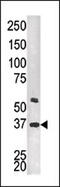 Twinfilin Actin Binding Protein 2 antibody, 62-709, ProSci, Western Blot image 