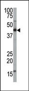 Farnesyltransferase, CAAX Box, Alpha antibody, 61-393, ProSci, Western Blot image 