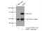 Membrane Palmitoylated Protein 7 antibody, 12983-1-AP, Proteintech Group, Immunoprecipitation image 