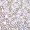 Kelch Like ECH Associated Protein 1 antibody, GTX54329, GeneTex, Immunohistochemistry paraffin image 