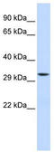 Mitochondrial Translational Initiation Factor 3 antibody, TA330929, Origene, Western Blot image 