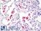 TRAcP antibody, LS-B10747, Lifespan Biosciences, Immunohistochemistry paraffin image 