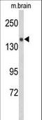 Semaphorin 5A antibody, LS-C168959, Lifespan Biosciences, Western Blot image 