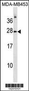 Ribonuclease A Family Member 1, Pancreatic antibody, 60-936, ProSci, Western Blot image 