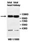 Protocadherin 10 antibody, orb77860, Biorbyt, Western Blot image 