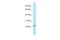 Mitochondrial Ribosomal Protein L43 antibody, A13204, Boster Biological Technology, Western Blot image 