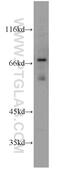Tubby-related protein 1 antibody, 18971-1-AP, Proteintech Group, Western Blot image 