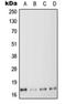 Myosin Light Chain 6 antibody, orb214289, Biorbyt, Western Blot image 