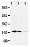 Galectin 1 antibody, LS-C312585, Lifespan Biosciences, Western Blot image 