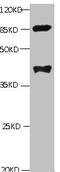 Phospholipase A2 Group VII antibody, abx210114, Abbexa, Western Blot image 