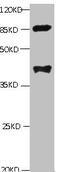 Phospholipase A2 Group VII antibody, abx210114, Abbexa, Western Blot image 