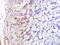 Fatty Acid Binding Protein 5 antibody, GTX51535, GeneTex, Immunohistochemistry paraffin image 