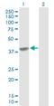 Complement Component 4 Binding Protein Beta antibody, H00000725-D01P, Novus Biologicals, Western Blot image 