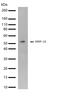 Matrix Metallopeptidase 10 antibody, 701288, Invitrogen Antibodies, Western Blot image 