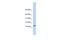 CMT1A Duplicated Region Transcript 4 antibody, A18312, Boster Biological Technology, Western Blot image 