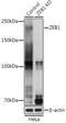 Zinc Finger E-Box Binding Homeobox 1 antibody, GTX55847, GeneTex, Western Blot image 