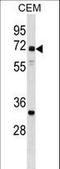 NPL4 Homolog, Ubiquitin Recognition Factor antibody, LS-C158418, Lifespan Biosciences, Western Blot image 