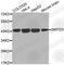 SET And MYND Domain Containing 3 antibody, A2329, ABclonal Technology, Western Blot image 