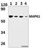 ERK-7 antibody, A10088-3, Boster Biological Technology, Western Blot image 