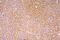 Complement Factor H antibody, A00562-2, Boster Biological Technology, Immunohistochemistry paraffin image 