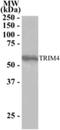 Tripartite Motif Containing 4 antibody, NB100-1225, Novus Biologicals, Western Blot image 