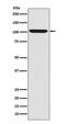 Leucine Rich Repeat Containing G Protein-Coupled Receptor 5 antibody, M00239, Boster Biological Technology, Western Blot image 