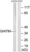 Growth Hormone Inducible Transmembrane Protein antibody, GTX87350, GeneTex, Western Blot image 