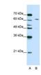 Cleavage And Polyadenylation Specific Factor 6 antibody, NBP1-57541, Novus Biologicals, Western Blot image 