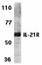 Interleukin 21 Receptor antibody, orb74451, Biorbyt, Western Blot image 