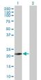 RAB26, Member RAS Oncogene Family antibody, H00025837-D01P, Novus Biologicals, Western Blot image 