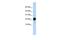 Chorionic somatomammotropin hormone-like 1 antibody, GTX47094, GeneTex, Western Blot image 