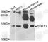 Dynein Light Chain Tctex-Type 1 antibody, A4150, ABclonal Technology, Western Blot image 