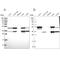 Citrate Lyase Beta Like antibody, PA5-59009, Invitrogen Antibodies, Western Blot image 