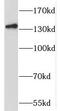 Solute Carrier Family 9 Member C2 (Putative) antibody, FNab07975, FineTest, Western Blot image 