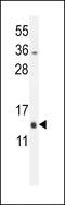 Mitochondrial Ribosomal Protein L51 antibody, LS-C162632, Lifespan Biosciences, Western Blot image 