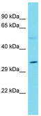 Olfactory Receptor Family 51 Subfamily B Member 2 (Gene/Pseudogene) antibody, TA330732, Origene, Western Blot image 
