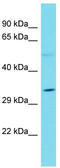 Olfactory receptor 51B1 antibody, TA330732, Origene, Western Blot image 