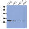 CASP2 And RIPK1 Domain Containing Adaptor With Death Domain antibody, GTX57605, GeneTex, Western Blot image 