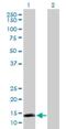 Angiotensin II Receptor Associated Protein antibody, H00057085-D01P, Novus Biologicals, Western Blot image 