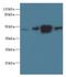 Protein Arginine Methyltransferase 6 antibody, A60418-100, Epigentek, Western Blot image 