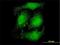 Atrophin 1 antibody, H00001822-M01, Novus Biologicals, Immunocytochemistry image 