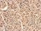 Reactive Intermediate Imine Deaminase A Homolog antibody, GTX119107, GeneTex, Immunohistochemistry paraffin image 