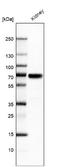 HNF1 Homeobox B antibody, NBP1-89680, Novus Biologicals, Western Blot image 