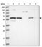 Rubicon Like Autophagy Enhancer antibody, NBP1-82141, Novus Biologicals, Western Blot image 