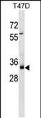 Myeloma Overexpressed antibody, PA5-48938, Invitrogen Antibodies, Western Blot image 