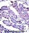 AKT Serine/Threonine Kinase 2 antibody, abx033128, Abbexa, Immunohistochemistry frozen image 