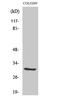 Abhydrolase Domain Containing 11 antibody, STJ91419, St John